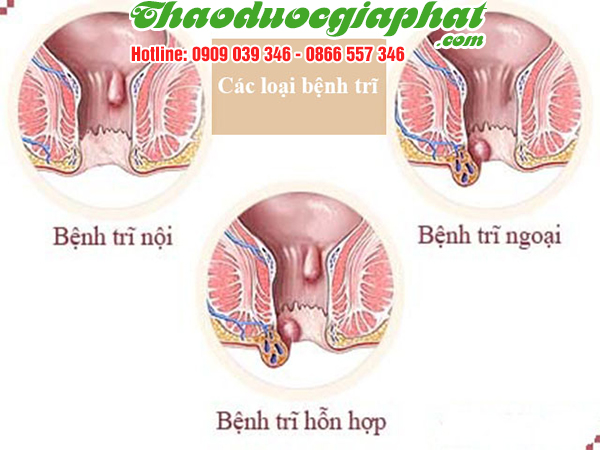 cay-mac-co-tri-tri-tai-quan-3