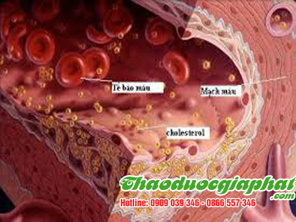 cay-no-ngay-dat-giup-khang-ung-thu-tai-quan-5