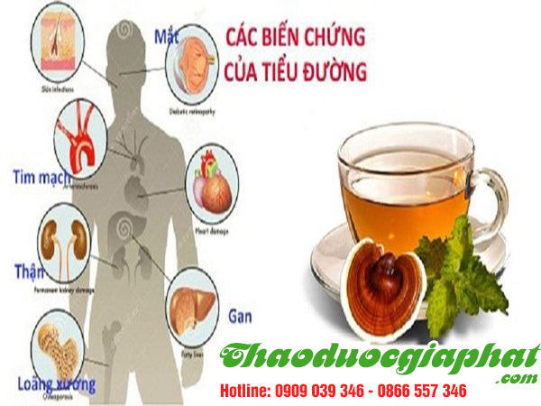 cay-no-ngay-dat-tri-benh-tieu-duong-tai-huyen-cu-chi