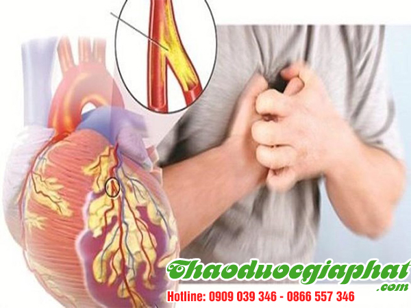 cay-no-ngay-dat-tri-benh-tim-tai-quan-7