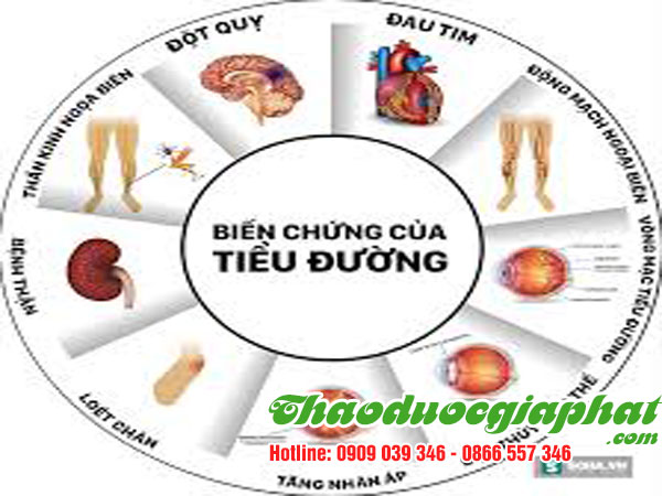 cay-no-ngay-dat-tri-tieu-duong-tai-quan-9