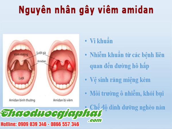 cay-sai-dat-chat-luong-nhat-tai-huyen-nha-be-dieu-tri-amidan