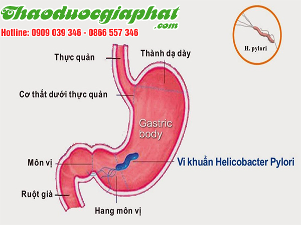 cay-sai-dat-chat-luong-nhat-tai-quan-11-tri-ung-thu-mon-vi