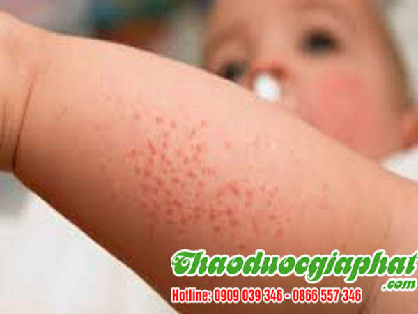 cay-sai-dat-chat-luong-nhat-tai-quan-6-tri-rom-xay