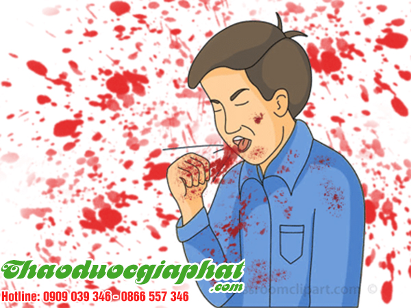 cay-sai-dat-chat-luong-nhat-tai-quan-tan-phu-ho-ra-mau