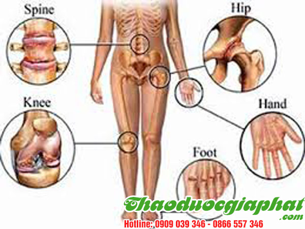 cay-thien-nien-kien-tri-thap-khop-tai-quan-6