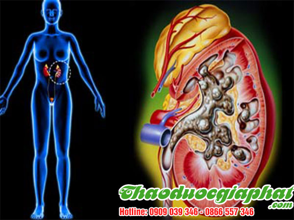 cay-thuoc-doi-tri-viem-duong-tiet-nieu-tai-huyen-can-gio