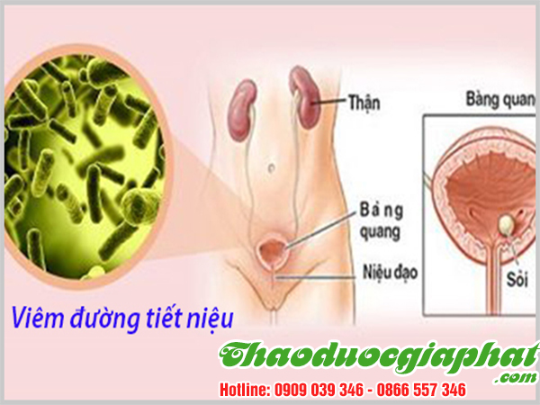 cay-thuoc-doi-tri-viem-duong-tiet-nieu-tai-quan-8.
