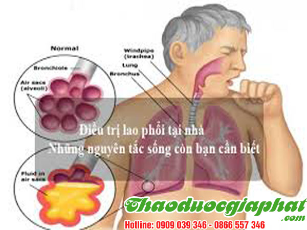 cu-ray-tri-lao-phoi-tai-quan-5