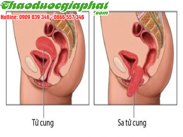 cu-ray-tri-sa-tu-cung-tai-quan-9