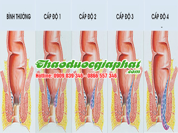 day-thia-canh-tri-benh-tri-tai-quan-11