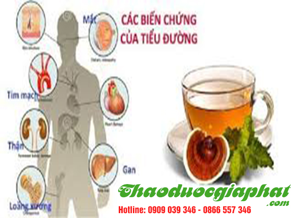 day-thia-canh-tri-tieu-duong-tai-quan-2