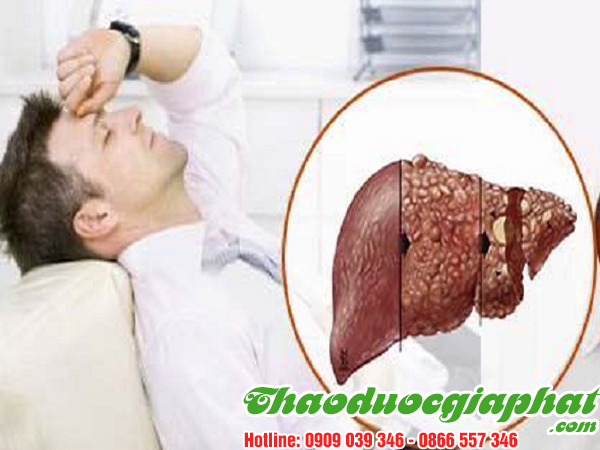 diep-ha-chau-dieu-tri-suy-gan-tai-huyen-nha-be