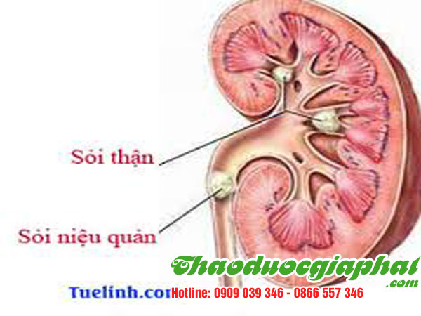 diep-ha-chau-giup-danh-tan-soi-than-tai-quan-12