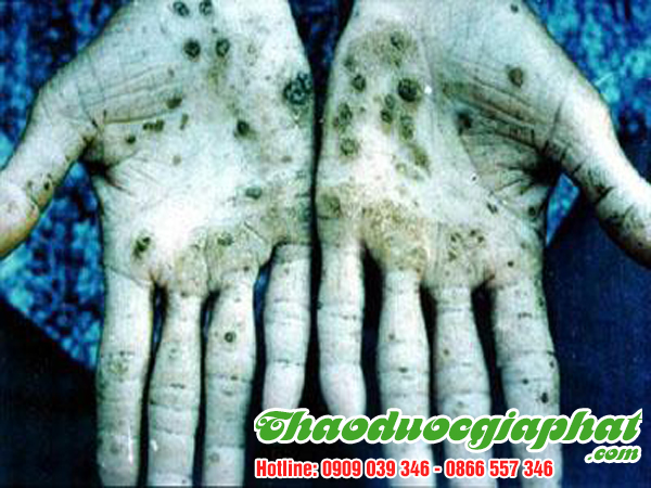 diep-ha-chau-giup-giai-doc-tai-quan-tan-binh