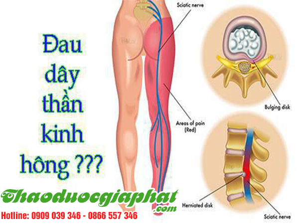 giup-dieu-tri-dau-day-than-kinh-hong-hieu-qua-tai-quan-binh-thanh.