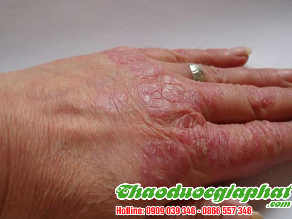 het-vay-nen-voi-kim-tien-thao-tai-quan-6