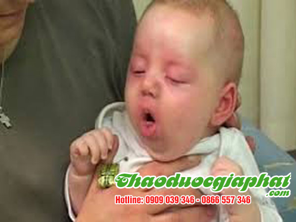 hoa-du-du-duc-tri-ho-ga-tai-quan-1