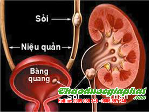 hoa-du-du-duc-tri-soi-mat-tai-quan-6