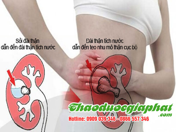 hoa-du-du-duc-tri-soi-than-tai-quan-5