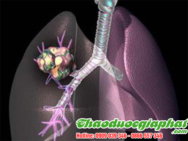 kich-thich-he-mien-dich-hieu-qua-tai-quan-7