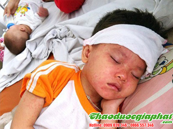 kim-ngan-hoa-tri-soi-taiquan-5-tot-nhat