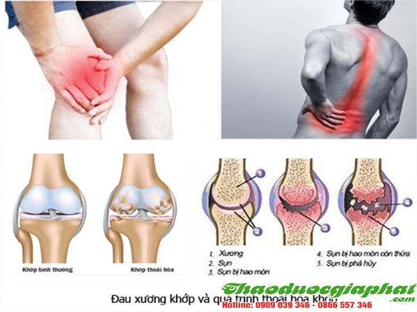 kim-ngan-hoa-tri-viem-khop-quan-binh-tan-tot-nhat