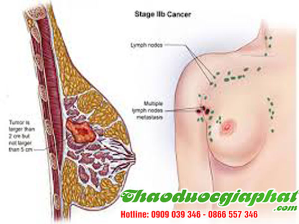 la-don-do-tai-quan-6-chat-luong-tri-benh-viem-sung-vu-tot-nhat