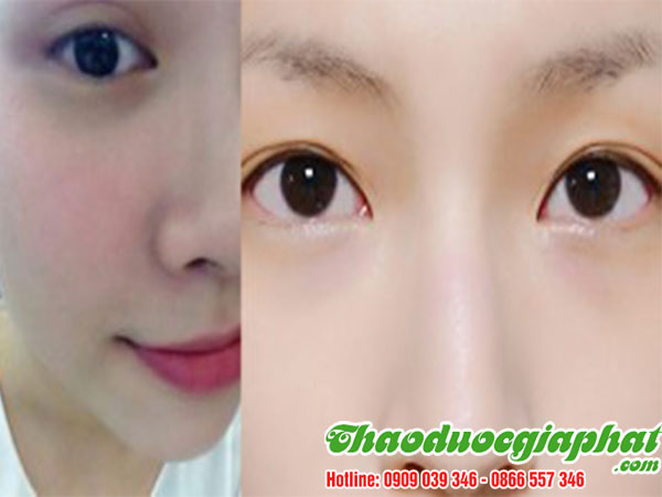 mua-ban-cay-co-ngot-uy-tin-chat-luong-tai-quan-thu-duc-lam-trang-da