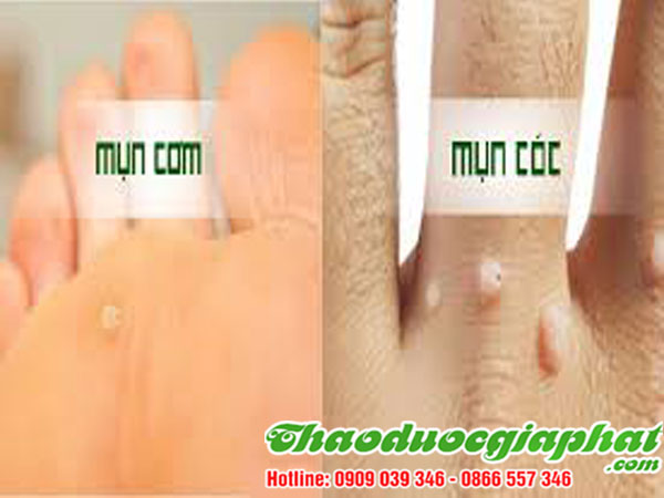 mua-ban-cay-giao-xuong-ca-uy-tin-chat-luong-tai-quan-10-tri-mun-com