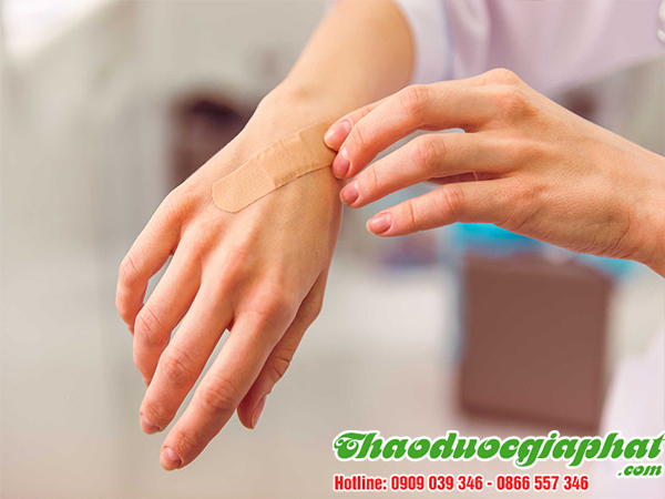 mua-ban-cay-han-the-uy-tin-chat-luong-tai-quan-10-chua-tri-vet-thuong-vet-loet