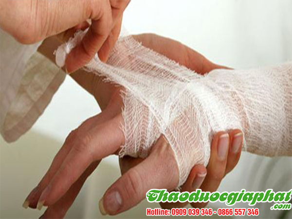 mua-ban-cay-han-the-uy-tin-chat-luong-tai-quan-7-tieu-viem-sung-cam-mau