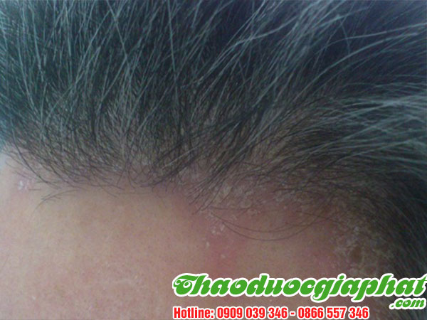 mua-ban-cay-han-the-uy-tin-chat-luong-tai-quan-binh-tan-tri-nam-da-dau