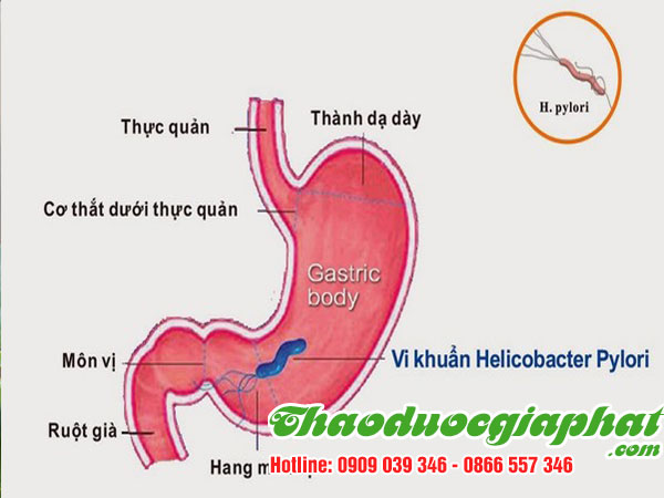 mua-ban-che-day-uy-tin-chat-luong-tại-quan-tan-binh-tri-tri