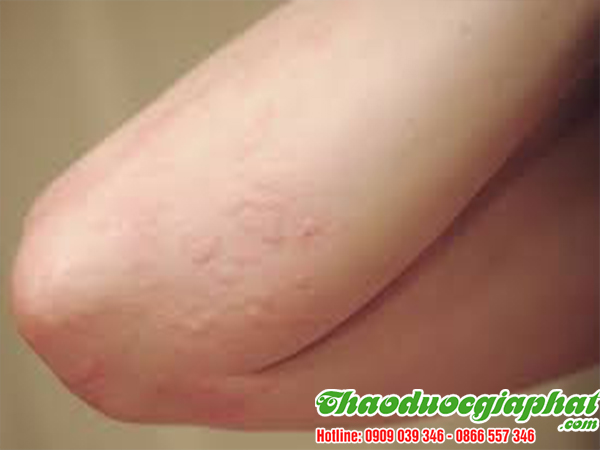 mua-ban-tao-do-uy-tin-chat-luong-tai-quan-1-tri-di-ung