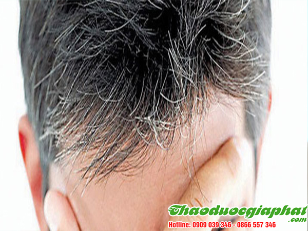 phan-ta-diep-dieu-tri-toc-bac-som-hieu-qua-nhat-tai-quan-8