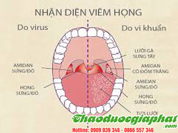 qua-sung-dieu-tri-viem-hong-tai-quan-8