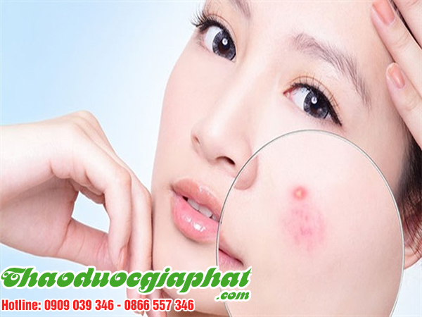 rau-den-gai-tri-ung-nhot-tai-quan-thu-duc