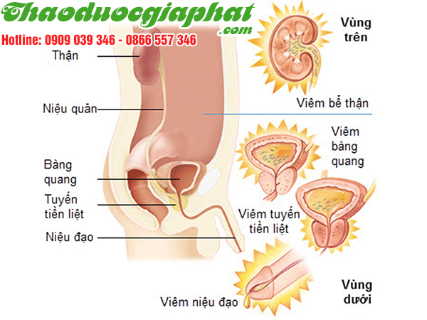 vo-que-tri-dut-diem-viem-duong-tiet-nieu-tai-huyen-binh-chanh